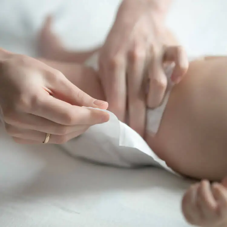 پیشگیری و درمان سوختگی پای نوزاد